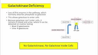 12DaysinMarch Galactose Metabolism for USMLE Step One [upl. by O'Hara217]