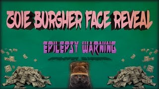 Zoie Burgher Face Reveal  EPILEPSY WARNING [upl. by Ydor]