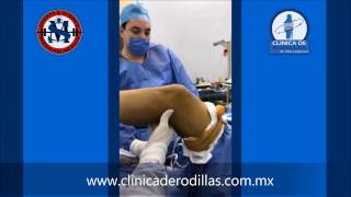 Clinica de Rodillas  Artroscopia para Reparación Ligamento Cruzado Anterior  México [upl. by Ennayelsel410]