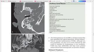 NEURORADIOLOGY CORE REQUISITES [upl. by Rolf472]