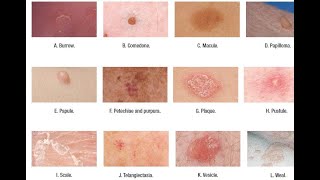 Skin Lesions with defination [upl. by Delwyn343]