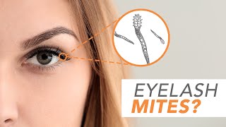 What are Demodex Mites Optometrist Explains [upl. by Lebama]