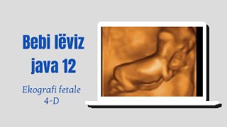 Eko fetale 4D java 12 e shtatzanise 12 weeks human embryo on 4D Ultrasound [upl. by Eecart]