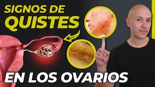 SI TIENES UNO DE ESTOS SÍNTOMAS PUEDES TENER QUISTES EN LOS OVARIOS  ¿CURAR EL OVARIO POLIQUÍSTICO [upl. by Ahsieyk]