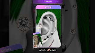 ASMR II EARWAX REMOVAL SATISFYING TREATMENT ANIMATIONDaDaASMR brainasmr2019 [upl. by Yrrem]