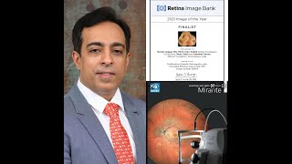 Multimodal Retinal Imaging using Mirante SLO  mirantemagic  Wide field Imaging  Dr Manish Nagpal [upl. by Charlean]