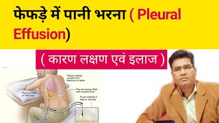 What is Pleural effusion its Cause Symptoms and Treatment Explained in Hindi फेफड़े में पानी [upl. by Wood264]