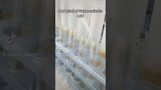 Protein Test Sulphosalicylic Acid Test for urine [upl. by Sej469]