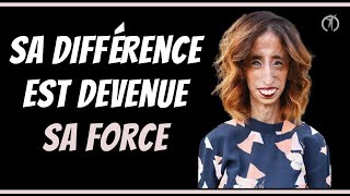 Revanche de la femme surnommée quotFemme la plus laide du mondequot  Lizzie Velasquez  MOTIVATION fr [upl. by Priest]