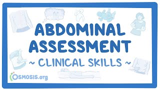 Abdominal Assessment Clinical Skills [upl. by Ettevroc]