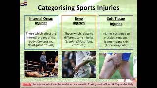 GCSE PE  Sports Injuries amp Prevention Methods [upl. by Lorilee]