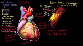 O que é Doença arterial coronariana [upl. by Mharg]