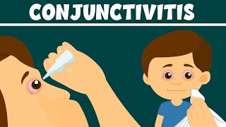 Conjunctivitis What Is Pink Eye  Types Symptoms and Treatment  Video for Kids [upl. by Kirtap]