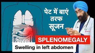 पेट में सूजन हो सकती है स्प्लीन  Splenomegaly  Swelling in Spleen  DrEducation [upl. by Sewoll]