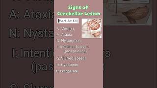 How to Remember the Signs of Cerebellar Disease 🤓🧠 anatomyfacts cerebellum clinicalanatomy [upl. by Biondo]