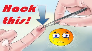 😷Splinter Removal HackHow to Remove a Splinter from your hand😰😁🐀 [upl. by Jaynes379]