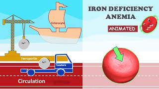 Iron Deficiency Anemia Everything you need to know ANIMATED with Lecture Notes [upl. by Eitteb]