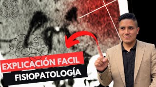 ✅Ictus Isquémico Fisiopatología 1 ABP Adulto Séptimo🧠 [upl. by Zakarias]