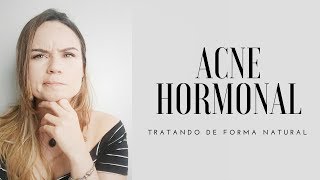 ACNE HORMONAL  COMO TRATAR DE FORMA NATURAL [upl. by Daggett]