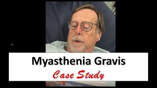 Myasthenia Gravis Case Study [upl. by Ybok]