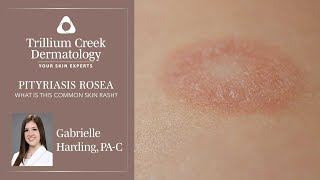 What is Pityriasis Rosea [upl. by Adriana699]