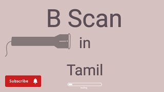 B Scan ultrasonography in Tamil [upl. by Misty421]