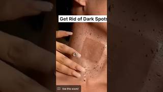 Neck cleaning Tips  Dark Neck Home Remedies Tanning Removal Tips😱 suntan ytshorts beauty skin [upl. by Naehgem932]