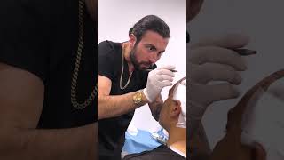 Oktay Tuney  Hair Transplant [upl. by Refeinnej]