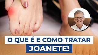 O que é Joanete Sintomas e Tratamentos [upl. by Africa]