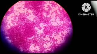 Staphylococcus aureus gram positive bacteria under the microscope 100x are seen [upl. by Berkin]