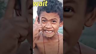 Iske danto ki sachai samne aa gyi 😂 funny roast [upl. by Bove]