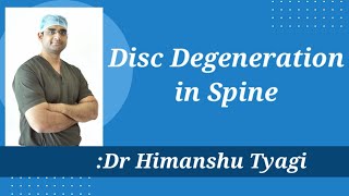 Disc Degeneration in spine [upl. by Raman66]