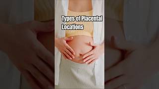 Placental Locations pregnancy placentapositionduringpregnancy [upl. by Calise69]