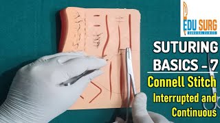 Intestinal anastomosis l Connell Stitch l OSCE skill stations part 7 l Surgical clinics [upl. by Glennie]