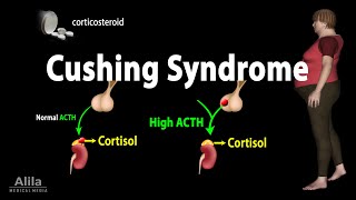 Cushing Syndrome Animation [upl. by Whitaker]