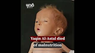 ⭕️ 💔 🇵🇸 Le nourrisson Palestinien 🇵🇸 Yaqin AlAshtal a succombé ce matin à une malnutrition [upl. by Ardith]