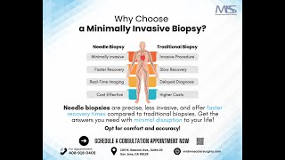 Why Choose a Needle Biopsy [upl. by Roley545]