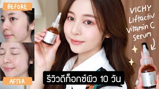 REVIEW ดีท็อกซ์ผิว 10 วันด้วย Vichy Liftactiv Vitamin C Serum ใช้จริงรีวิวจริง ✨  Babyjingko [upl. by Naitsabas]