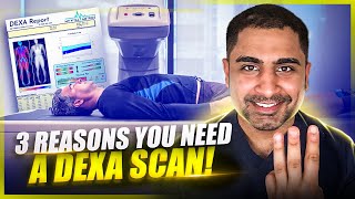 3 reasons you NEED a DEXA scan [upl. by Rivera]