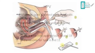 STDs Overview [upl. by Che]