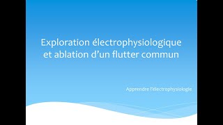 Exploration électrophysiologique et ablation dun flutter commun [upl. by Eiramana]