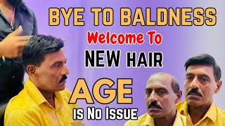 Hair replacement Srilanka age No issue for baldness  Baldness solution srilanka ushine [upl. by Acnaiv]