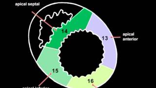 Volodymyr Pavliuk MD PhD Echocardiographic Assesment of Left Ventricular Systolic Function [upl. by Fusuy75]