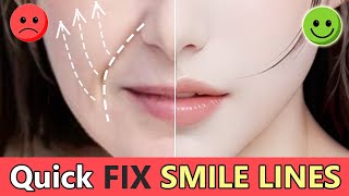 Quick Remove Smile lines Nasolabial Fold Lift Saggy Cheeks Fill Cheek lines  Short Time [upl. by Agni]