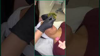 SQT Spongilla spicules🌵 are painless biomicroneedling skin beauty salon acne skincaretips [upl. by Lienhard]