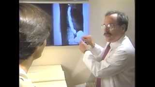 What is Gastroesophageal Reflux Disease GERD [upl. by Puri90]