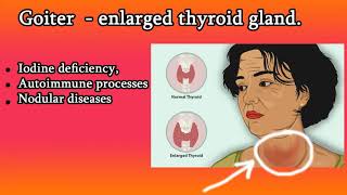 Goiter  Causes symptoms and Treatment [upl. by Chicky]