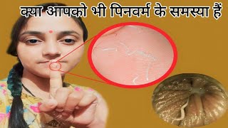 सिर्फ 1 रात मे Pinworms होगा खत्म  How to get rid of Pinworms  Threadworms treatment at home [upl. by Alael]