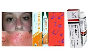 fucidin H cream usesSide EffectsDosage review in Hindi or Urdu [upl. by Karena]