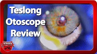 Teslong Digital Otoscope Review [upl. by Leima928]